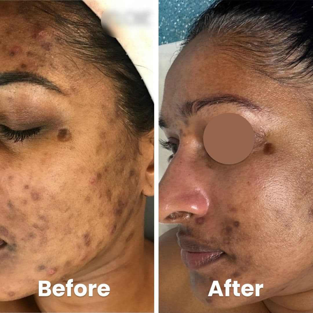 Spots / pigmentation