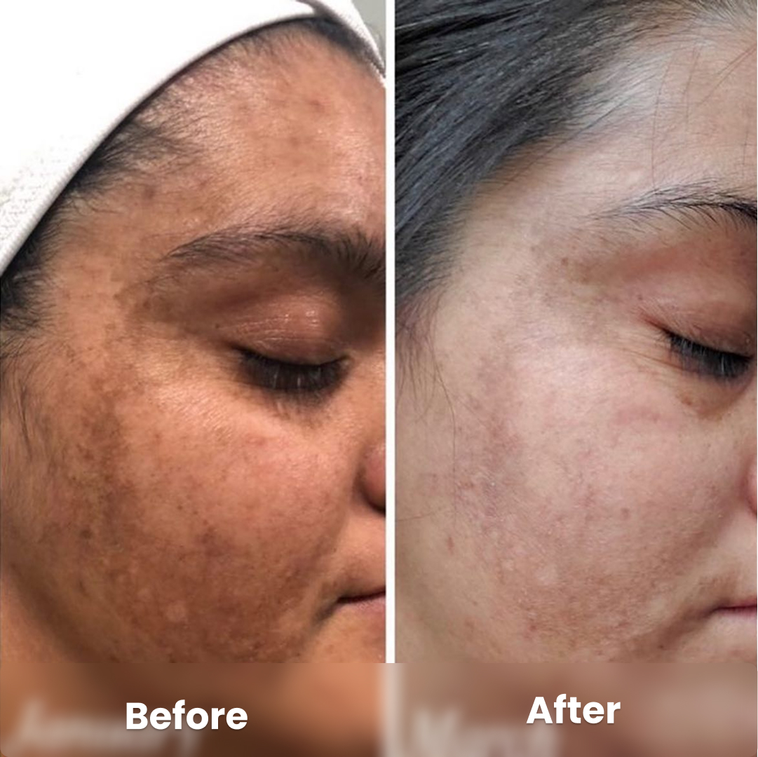 imgi_1_178676550_3019451028300770_6202876965790583088_n